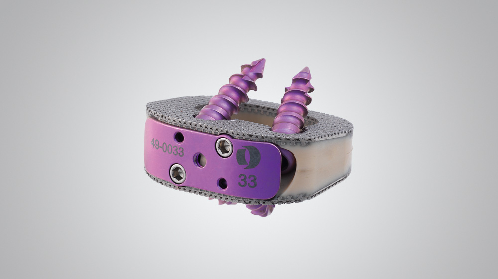 PILLAR SA PTC Spacer System Orthofix US